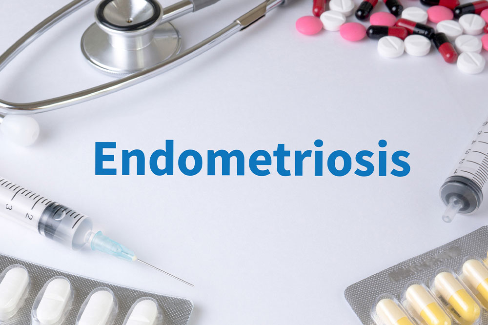 Endometriosis &#8211; Symptoms and natural remedies