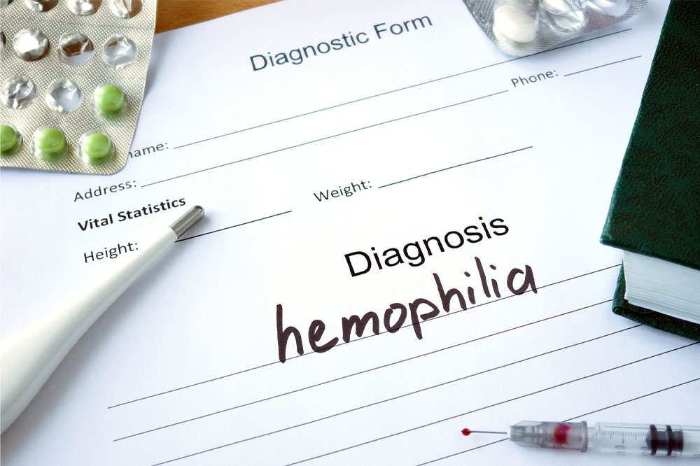 Hemophilia &#8211; Its types, symptoms, and management